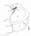 Fig. 05 - Device, system, and method for treating a regurgitant heart valve