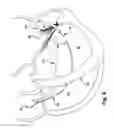 Fig. 07 - Device, system, and method for treating a regurgitant heart valve