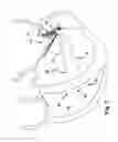 Fig. 08 - Device, system, and method for treating a regurgitant heart valve