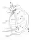 Fig. 12 - Device, system, and method for treating a regurgitant heart valve