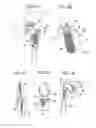 Fig. 07 - MEDICAL DEVICE AND SURFACE MODIFICATION METHOD FOR MEDICAL DEVICE