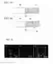 Fig. 08 - MEDICAL DEVICE AND SURFACE MODIFICATION METHOD FOR MEDICAL DEVICE