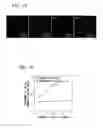 Fig. 12 - MEDICAL DEVICE AND SURFACE MODIFICATION METHOD FOR MEDICAL DEVICE
