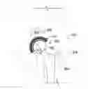 Fig. 01 - Joint replacement or joint resurfacing devices, systems and methods