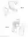 Fig. 02 - Joint replacement or joint resurfacing devices, systems and methods