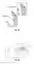 Fig. 05 - Joint replacement or joint resurfacing devices, systems and methods