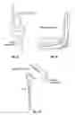 Fig. 07 - Joint replacement or joint resurfacing devices, systems and methods