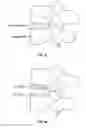 Fig. 09 - Joint replacement or joint resurfacing devices, systems and methods