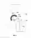Fig. 15 - Joint replacement or joint resurfacing devices, systems and methods