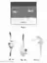 Fig. 16 - Joint replacement or joint resurfacing devices, systems and methods