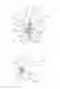 Fig. 02 - Interspinous implants