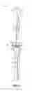 Fig. 02 - TIBIAL PROSTHESIS SYSTEMS, KITS, AND METHODS