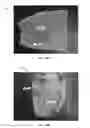 Fig. 28 - Systems, Devices, and Methods for Prosthetic Socket Adjustment