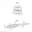 Fig. 03 - Endo-urethral prosthesis