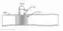 Fig. 01 - Systems for attaining a predetermined porosity of a vascular device