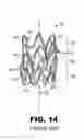 Fig. 08 - Stent crimping tool insert, system, and method