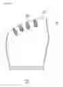 Fig. 03 - TOE CORRECTION DEVICE