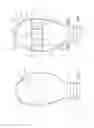 Fig. 04 - Ostomy appliance