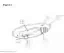 Fig. 03 - HYDRO-BLOCK AIR VENT FEMALE EXTERNAL CATHETER AND METHOD OF USE