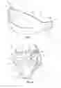 Fig. 07 - Headgear for protective headwear
