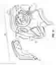 Fig. 09 - Removable shield for protective headwear