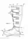 Fig. 02 - Compressive therapeutic device