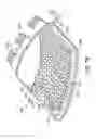 Fig. 06 - Compressive therapeutic device