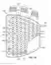 Fig. 07 - Compressive therapeutic device