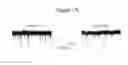 Fig. 21 - METHODS OF TREATING AUTISM WITH mGluR5 ANTAGONISTS