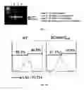 Fig. 10 - Methods of treating, preventing and diagnosing leukemia and other blood diseases and disorders