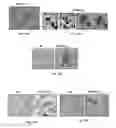 Fig. 16 - Methods of treating, preventing and diagnosing leukemia and other blood diseases and disorders