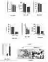 Fig. 20 - Methods of treating, preventing and diagnosing leukemia and other blood diseases and disorders