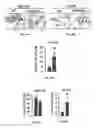 Fig. 21 - Methods of treating, preventing and diagnosing leukemia and other blood diseases and disorders