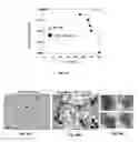 Fig. 27 - Methods of treating, preventing and diagnosing leukemia and other blood diseases and disorders