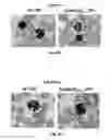 Fig. 29 - Methods of treating, preventing and diagnosing leukemia and other blood diseases and disorders