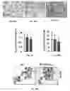 Fig. 32 - Methods of treating, preventing and diagnosing leukemia and other blood diseases and disorders