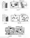 Fig. 33 - Methods of treating, preventing and diagnosing leukemia and other blood diseases and disorders