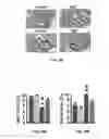 Fig. 45 - Methods of treating, preventing and diagnosing leukemia and other blood diseases and disorders