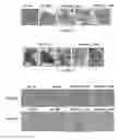 Fig. 48 - Methods of treating, preventing and diagnosing leukemia and other blood diseases and disorders