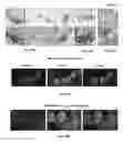 Fig. 54 - Methods of treating, preventing and diagnosing leukemia and other blood diseases and disorders