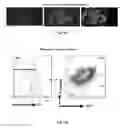 Fig. 55 - Methods of treating, preventing and diagnosing leukemia and other blood diseases and disorders