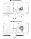 Fig. 56 - Methods of treating, preventing and diagnosing leukemia and other blood diseases and disorders