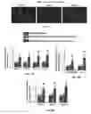 Fig. 57 - Methods of treating, preventing and diagnosing leukemia and other blood diseases and disorders