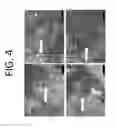 Fig. 05 - EXTENDED-RELEASE DRUG DELIVERY COMPOSITIONS