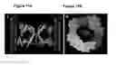 Fig. 22 - Methods and compositions comprising a C-terminal Bax peptide