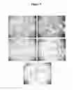 Fig. 11 - THERAPEUTIC METHOD