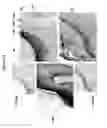 Fig. 21 - THERAPEUTIC METHOD