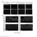 Fig. 13 - METHOD AND COMPOSITION FOR CONFERRING NEUROPROTECTION