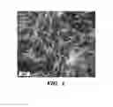 Fig. 02 - METHODS OF INCREASING NEURONAL CONNECTIVITY AND/OR TREATING A NEURODEGENERATIVE CONDITION