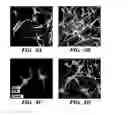 Fig. 04 - METHODS OF INCREASING NEURONAL CONNECTIVITY AND/OR TREATING A NEURODEGENERATIVE CONDITION